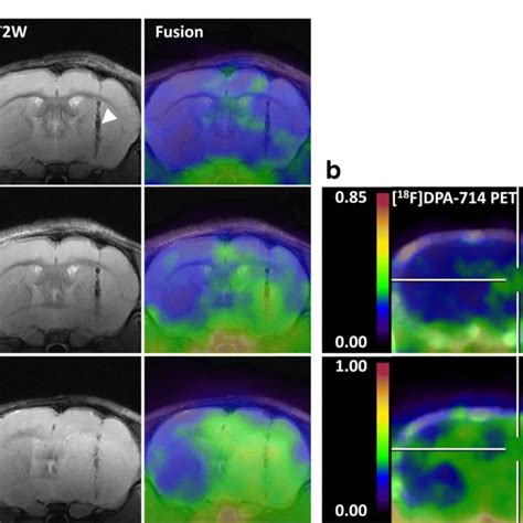 Imaging Of The Glioma Microenvironment By Tspo Pet Request Pdf