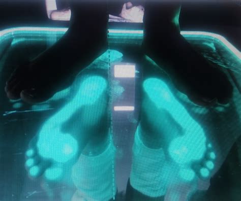 3D компютърен анализ на... - Foot Lab - Ортопедични стелки