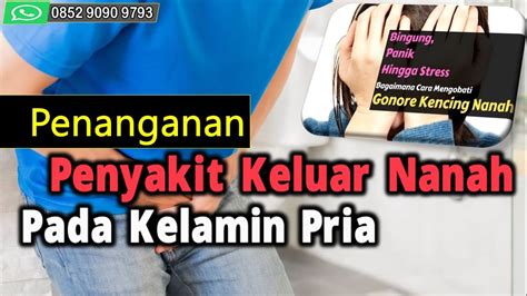 Penanganan Penyakit Keluar Nanah Pada Kelamin Pria YouTube