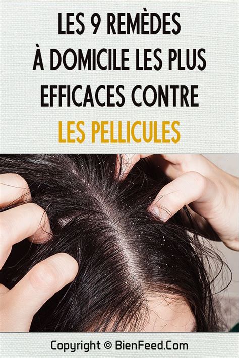 Les 9 remèdes à domicile les plus efficaces contre les pellicules