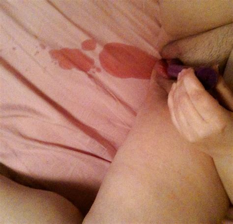 Enema Twister Round Porn Pictures XXX Photos Sex Images PICTOA