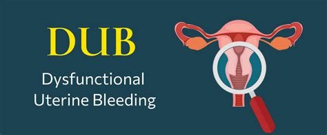 Dysfunctional Uterine Bleeding - Causes, Symptoms And Treatment