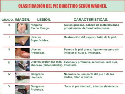 Clasificacion De Wagner Del Pie Diabetico Images Hot Sex Picture