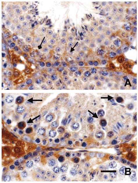 Representative Light Micrographs Of Immunostaining Of Inos On