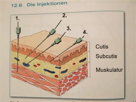 Terminologie Injektionen Karteikarten Quizlet