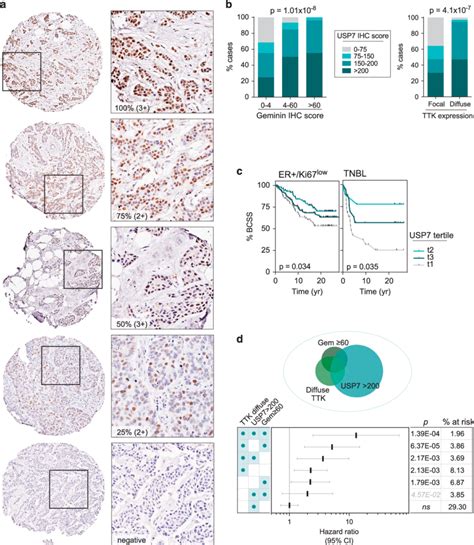 Expression Of Geminin And USP7 Is Strongly Correlated In Invasive