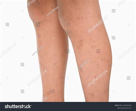 Painful Leg Boy Images Stock Photos Vectors Shutterstock