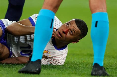 Mbappe Breaks His Nose A Nation Waits Your Guide To Copa Groups The