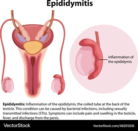 Male Epididymis And Testis Anatomy Infographic Vector Image