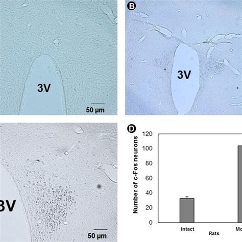 Figue 2 Photomicrographs Showing The Expression Of C Fos Protein In