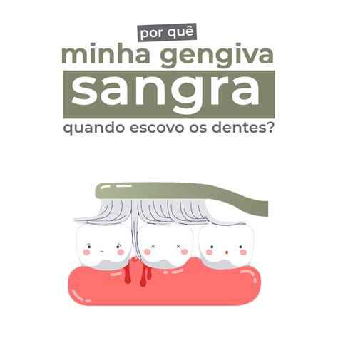 Minha Gengiva Sangra Do Nada - Gengiva Sangrando Durante Escovação É Normal? Saiba Como Evitar – FIHIDU