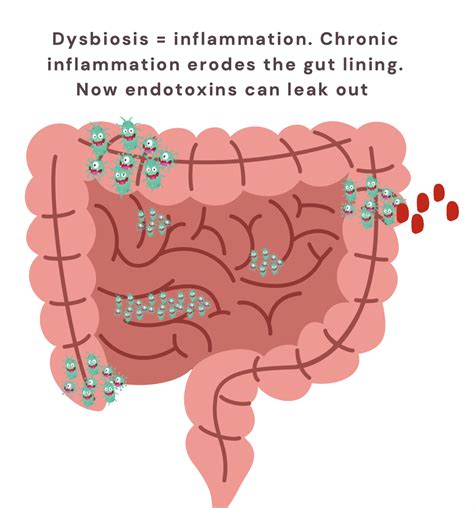 Understanding And Managing Endometriosis Symptoms Core Recovery