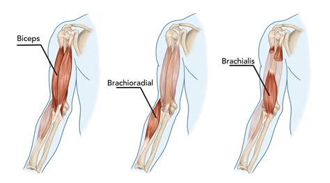 What Causes A Bicep To Tear How To Prevent And Treatment Options Pop