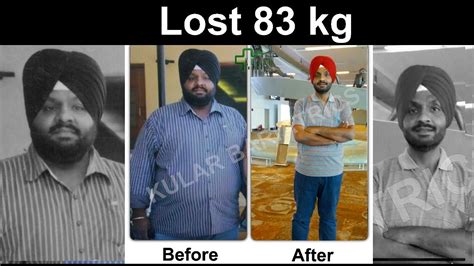 Can We Gain Weight After Bariatric Surgery Patient S Experience 8 5