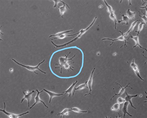 Bacterial Contamination Cell Culture