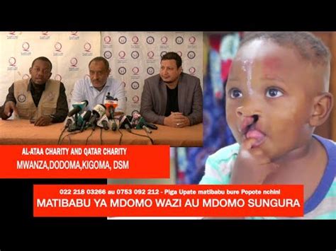 QATAR CHARITY NA AL ATAA KUTOA MATIBABU BURE KWA WATOTO WENYE MDOMO