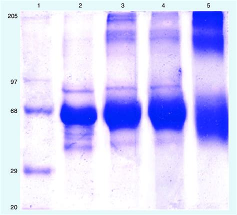 Sodium Dodecyl Sulfate Polyacrylamide Gel Electrophoresis Of