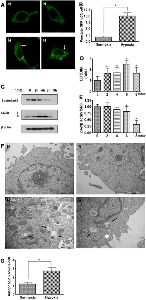 Hypoxia Induces Autophagy In Cancer Cells A Lc3 Gfp Distribution By Download Scientific