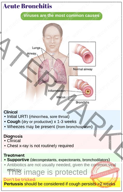 Acute bronchitis - Medicine Keys for MRCPs