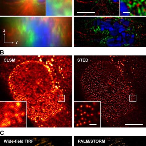 Super Resolution Microscopy Of Biological Samples A Conventional