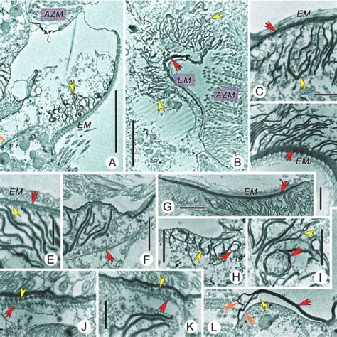 Transmission Electron Micrographs Showing The Ciliature Of Diophrys