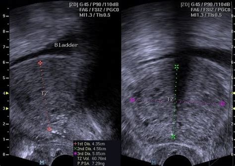 How Much Does An Ultrasound Cost And Why You Need This Career Best