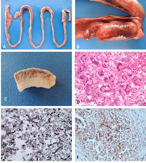 Intussusception Secondary To Intestinal Pythiosis In A Bitch A