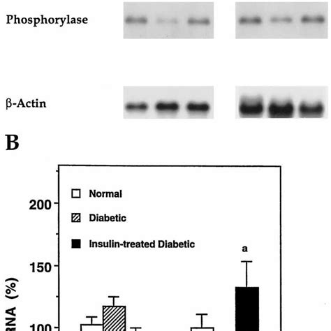 Northern Blot Analysis A And Quantitation B Of The Relative Levels