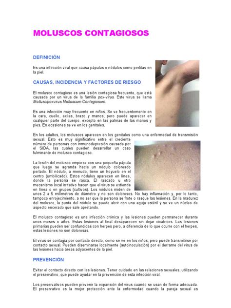 Moluscos Contagiosos Immunology Rtt