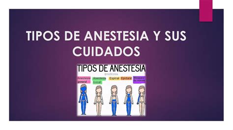 02 09 TIPOS DE ANESTESIA Y SUS CUIDADOS Yesua Gustavo UDocz