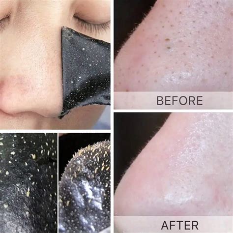 10pcs Pack Deep Cleansing Charcoal Blackhead Nose Strips Effectively