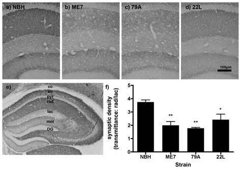 Sy Labelling Of The Presynaptic Marker Synaptophysin In A Nbh B