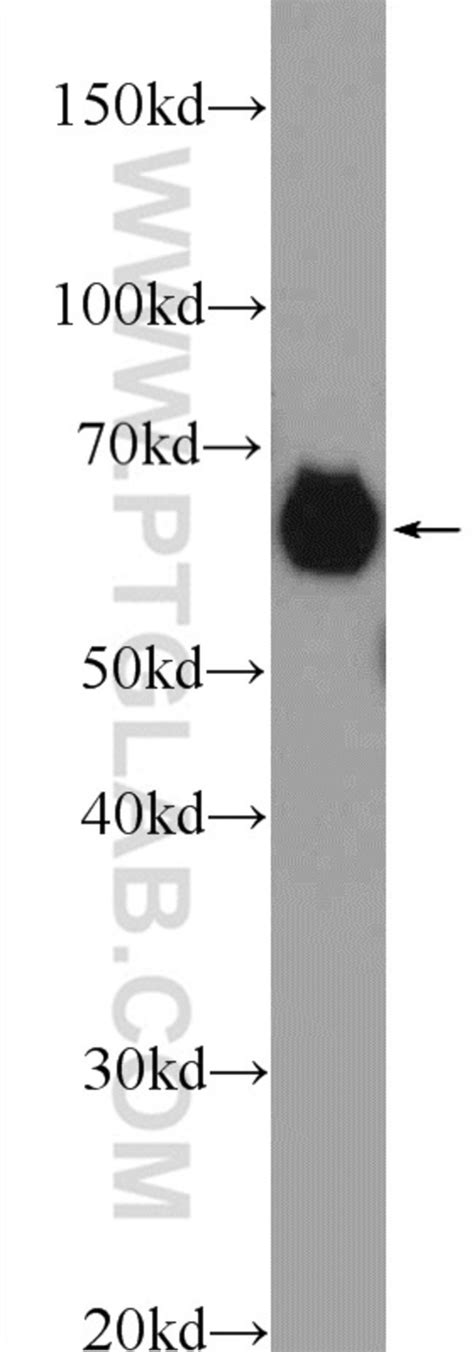 Aldh A Rabbit Anti Human Mouse Rat Polyclonal Proteintech L