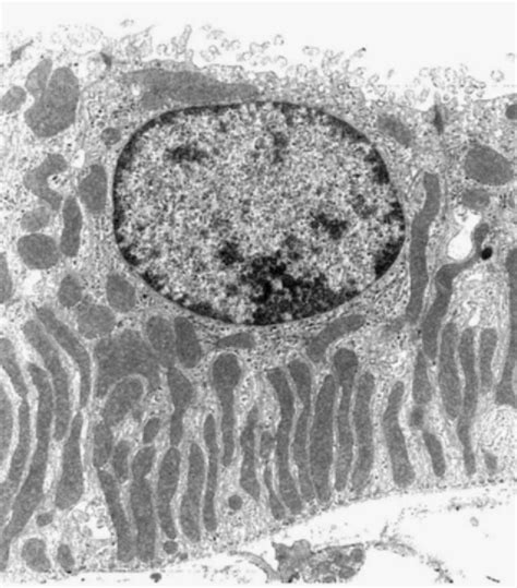 1 Transmission Electron Micrograph Of The Distal Convoluted Tubule