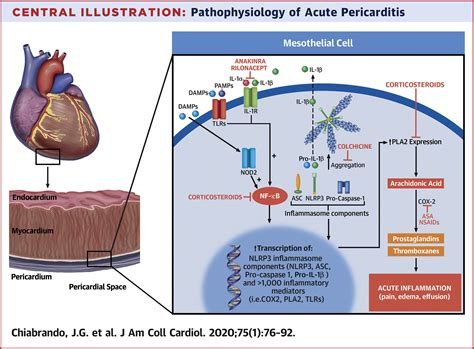 Management Of Acute And Recurrent Pericarditis Jacc State Of The Art