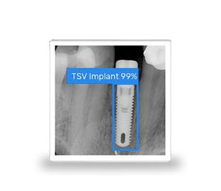 Biomet I Full Osseotite Tapered Certain Implante Dental Spotimplant