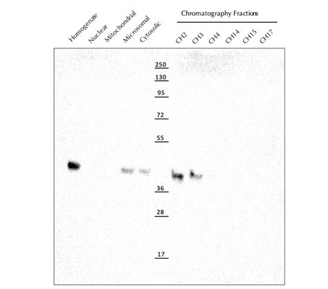 Solved (A) What is GAPDH and what does it do in the cell? | Chegg.com