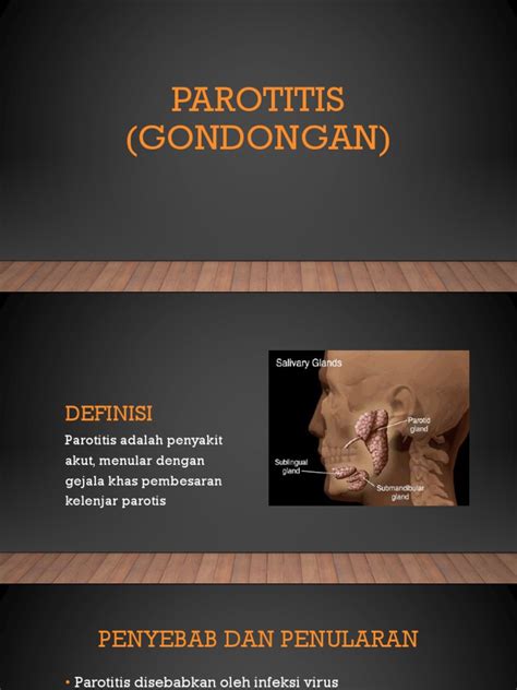 parotitis