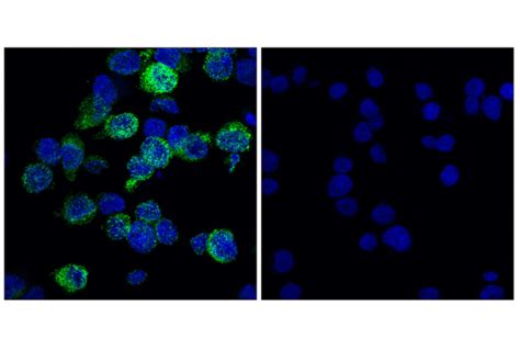 Cd Mrc E T J Xp Rabbit Mab Cell Signaling Technology