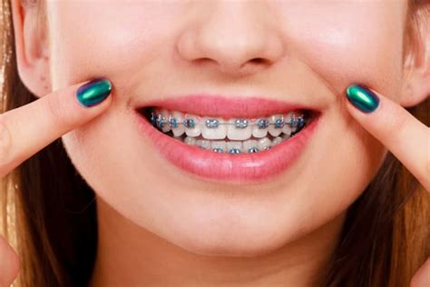 Surrey Orthodontist Braces Invisalign For All Ages