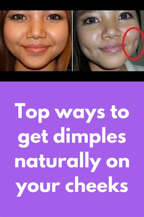 The Ultimate Guide To Getting Enchanting Cheek Dimples