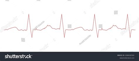 Electrocardiogram Template Heart Beat Diagram Ecg Stock Vector (Royalty ...