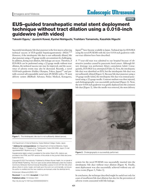 Pdf Eus Guided Transhepatic Metal Stent Deployment Technique Without