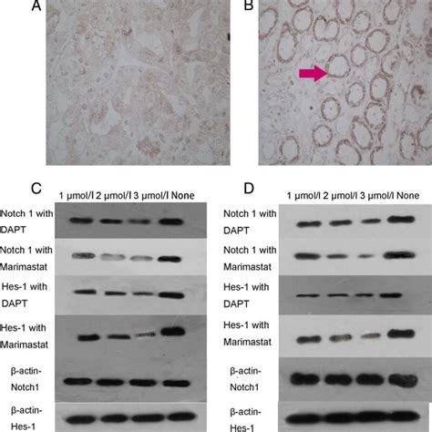 Expression Of Notch1 And HES 1 Proteins In 786 O And OS RC 2 Cells A