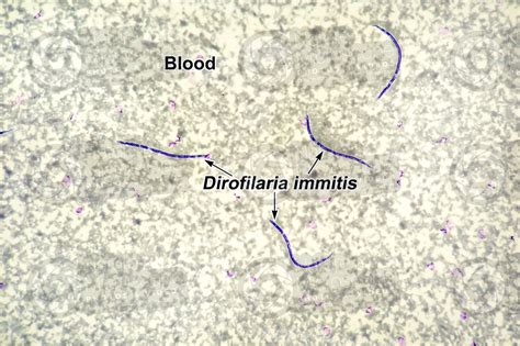 Dirofilaria immitis. Dirofilariasis. 125X - Nematoda (Nematodes ...