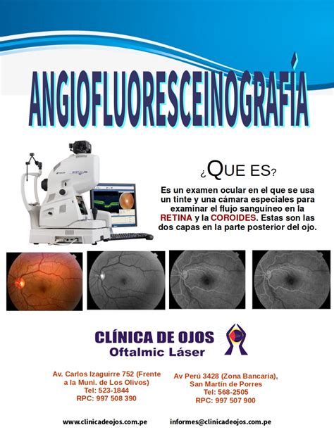 Cl Nica De Ojos Oftalmic L Ser Angiofluoresceinograf A