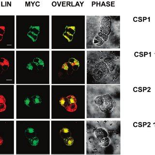 Localization Of Wild Type And C Terminally Truncated Csps Upon