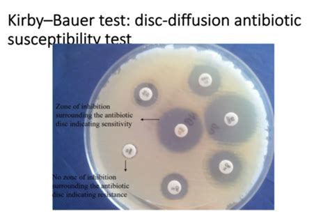 Clinical Bacteriology Flashcards Quizlet