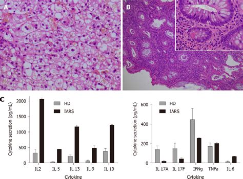 Figure From Refractory Very Early Onset Inflammatory Bowel Disease