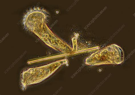 Stentor Sp Ciliates Light Micrograph Stock Image C056 6110